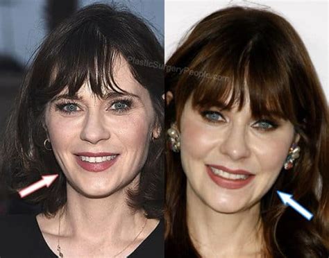 zooey deschanel facelift|Zooey Deschanel, Before and After